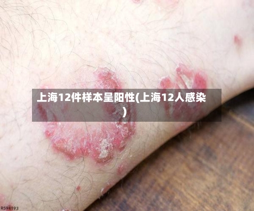 上海12件样本呈阳性(上海12人感染)-第2张图片